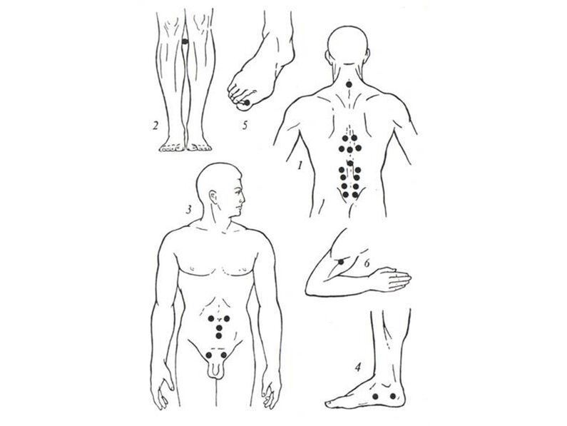 Acupunctuurmassage